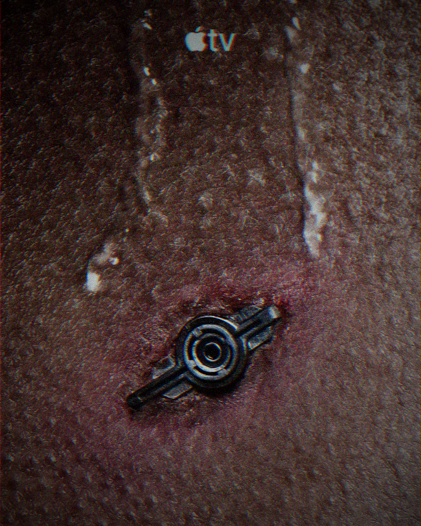 Neuromancer Apple TV+ — Body implant extreme close-up